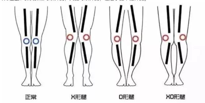 儿童骨健康与身高的“亲密关系”-超声骨密度仪(图2)