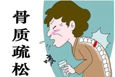 云南昆明|中仁骨密度仪厂家浅谈骨质疏松症的药物选择