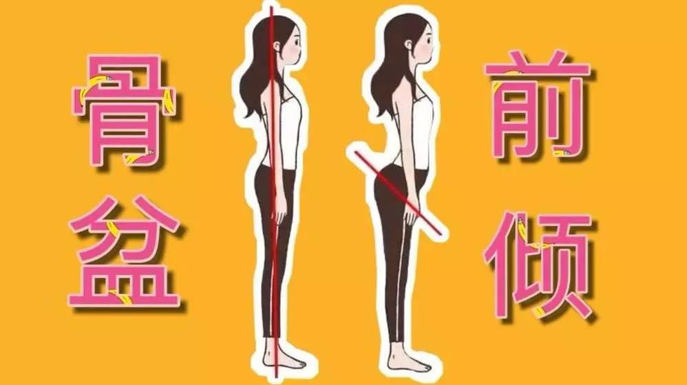 【中仁快讯】超声骨密度仪品牌告诉您注意骨盆前倾的四大危害,一个比一个严重!